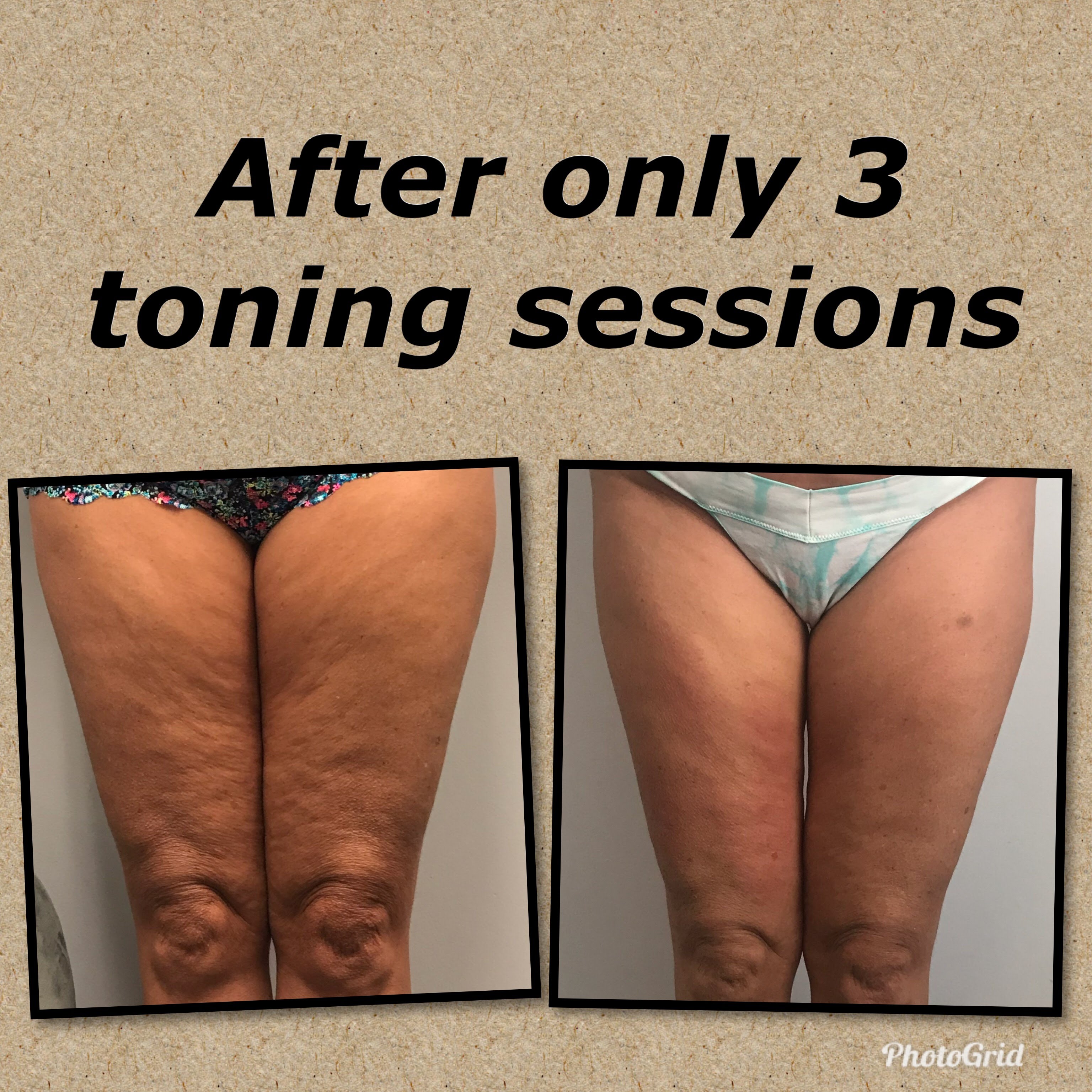 After 3 toning sessions - thighs